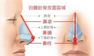做鼻子要多少钱